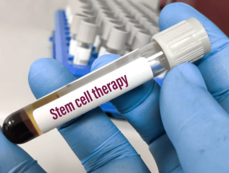 Stem Cell Therapy Tijuana: Benefits, Process, and Recovery Guide