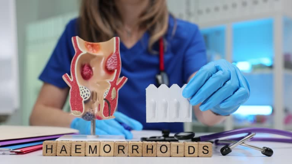 Modern Approaches to Lasting Relief with Non Surgical Hemorrhoid Treatment